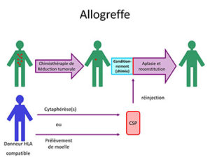 Schéma de l'allogreffe