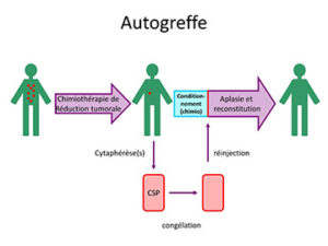 Schéma de l'autogreffe