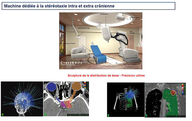 Machine dédiée à la stéréotaxie intra et extra crânienne