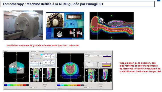 Images sur la thomothérapie