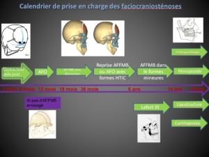 Le calendrier de prise en charge des faciocraniosténoses