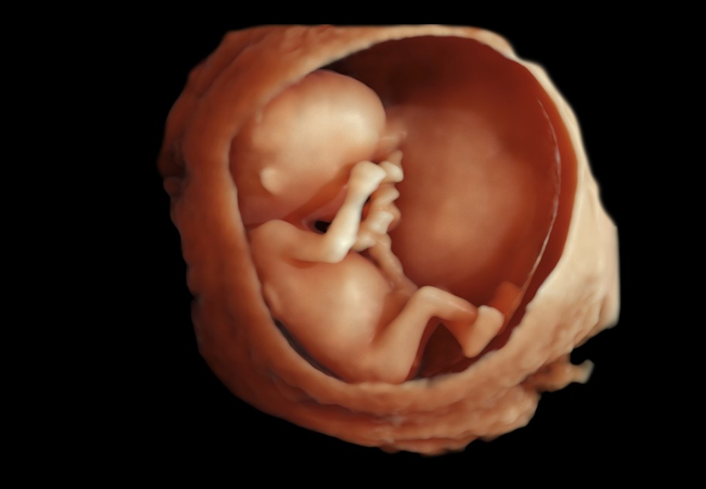 Maternité Olympe de Gouges - hôpital Bretonneau - PregnanT·SEE – Centre de dépistage du premier trimestre