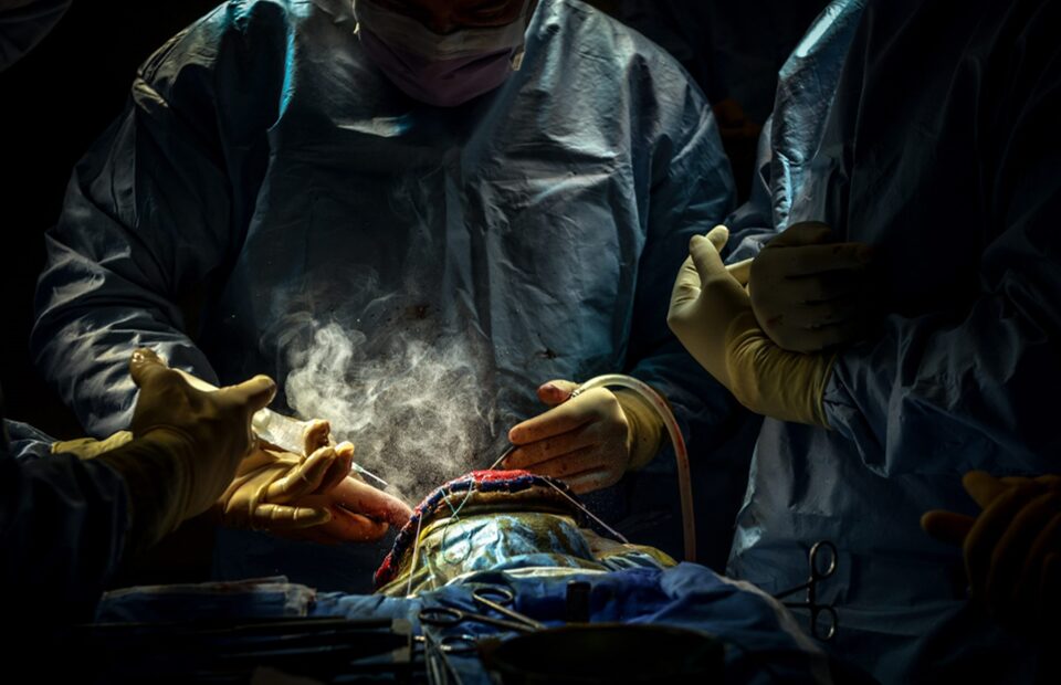 accueil Neurochirurgie, image d'une intervention