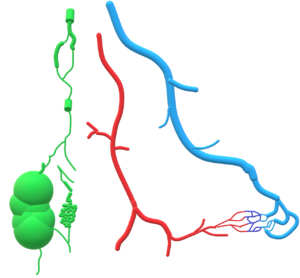 En vert, les vaisseaux lymphatiques présentent une malformation (en bas de l’image). Ces lymphangiomes sont typiquement macrokystiques (gros kystes, à gauche), ou microkystiques (à droite).
